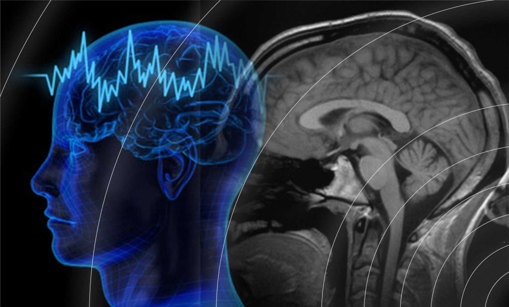 Sound therapy effect onthe human brain with Natural Tuning